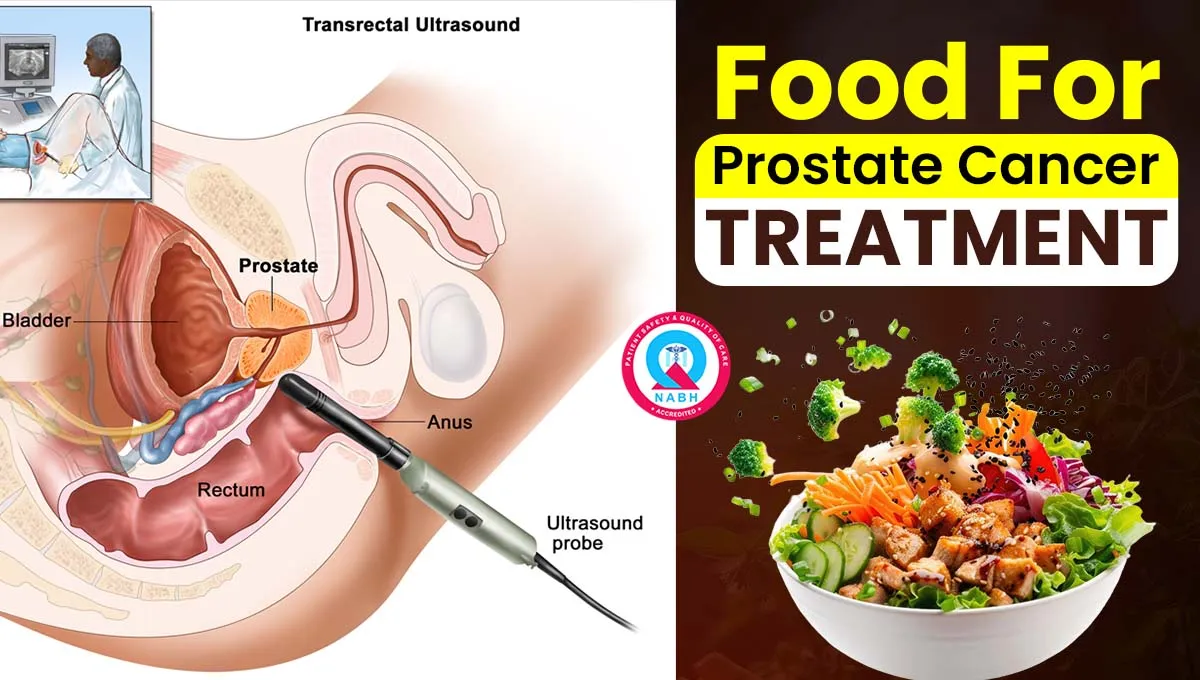 Food For Prostate Cancer Treatment